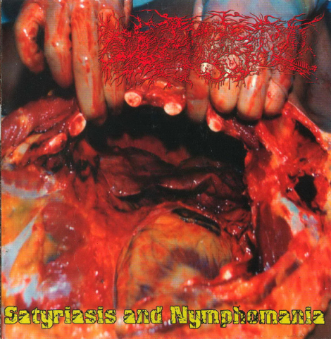 Paracoccidioidomicosisproctitissarcomucosis - Satyriasis And Nymphomania (CD)